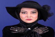آشا محرابی قبل از عمل زیبایی