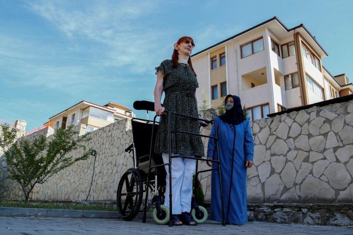 رومیسا گلگی قدبلندترین زن جهان