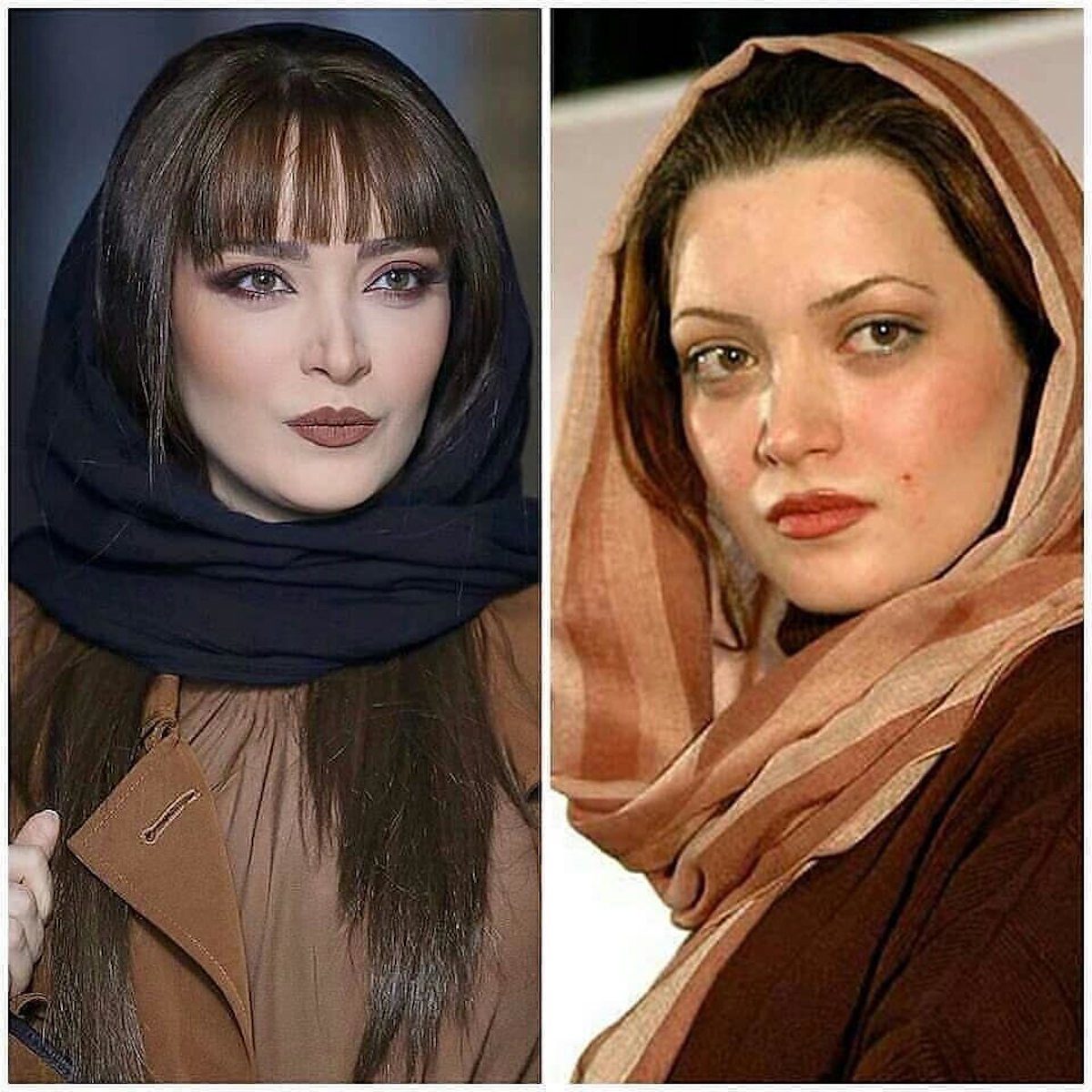 بهنوش طباطبایی قبل و بعد از عمل زیبایی