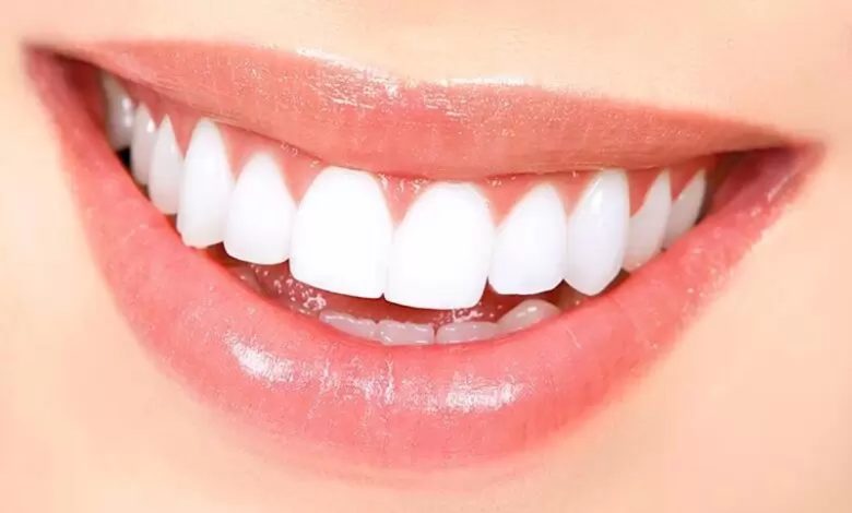 سفید شدن دندان