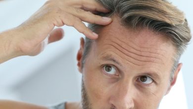 درمان ریزش مو در مردها