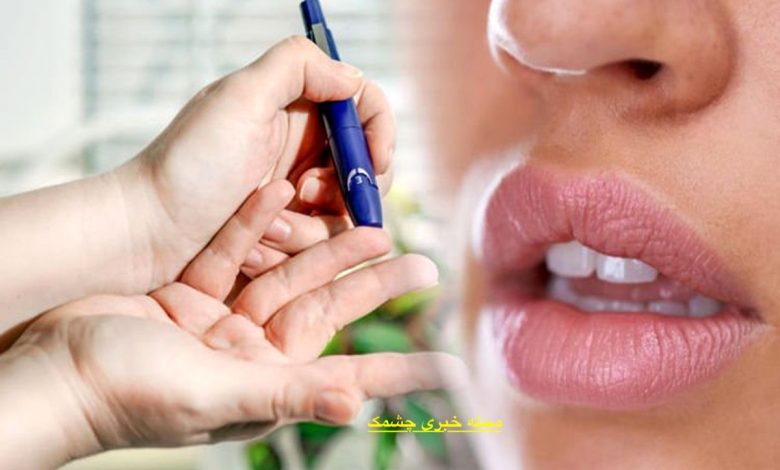  علت خشکی دهان دیابت