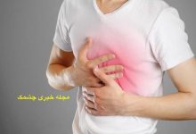 رفع سوزش سردل