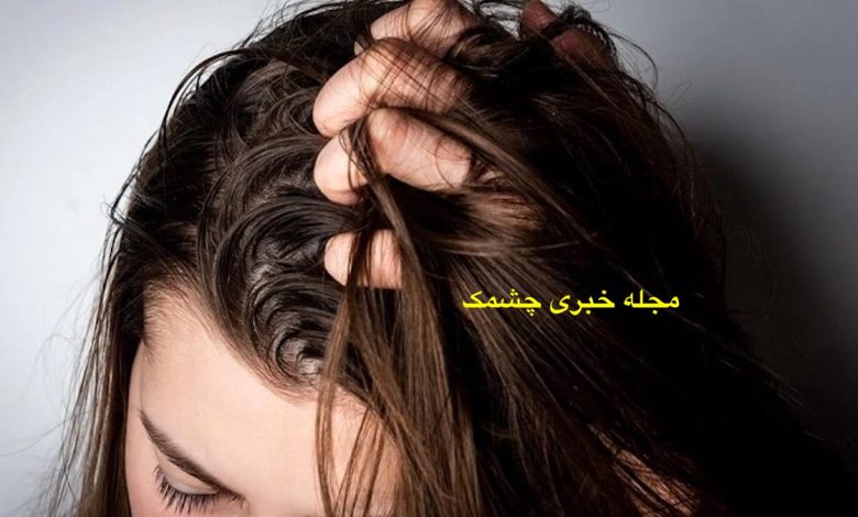  مراقبت از موهای چرب