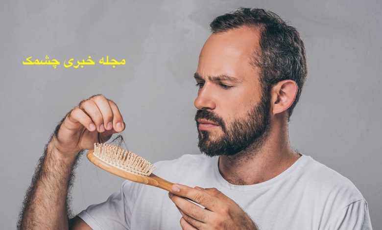 بهترین روش‌ جلوگیری از ریزش مو