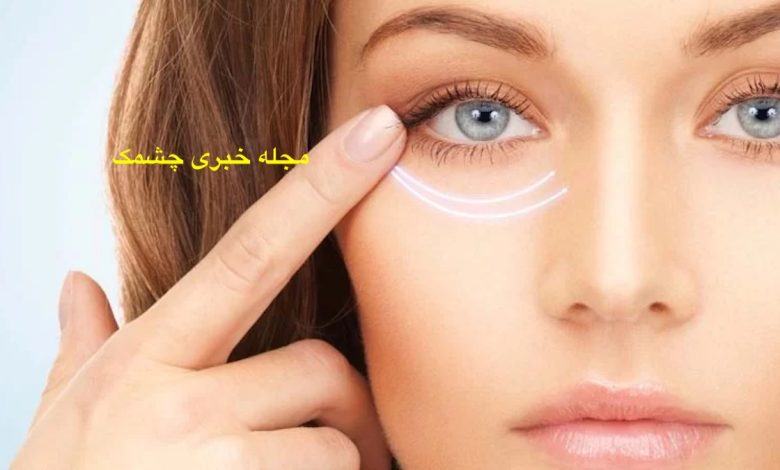 از بین بردن چروک‌های اطراف چشم