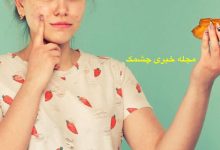 مواد غذایی که باعث جوش می شوند