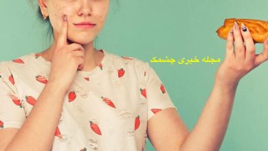 مواد غذایی که باعث جوش می شوند
