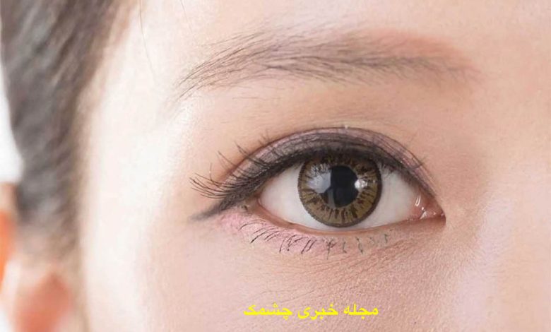 ریزش ابرو