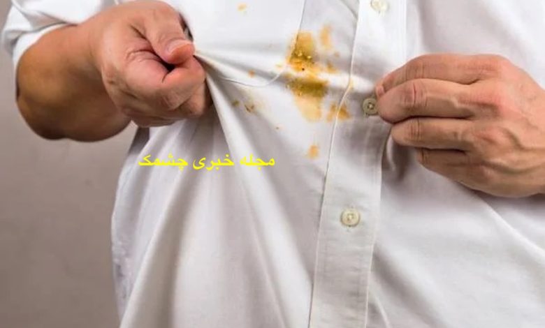 از بین بردن لکه ها