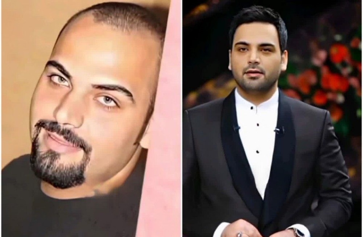 بازیگران مشهور قبل و بعد از شهرت قبل