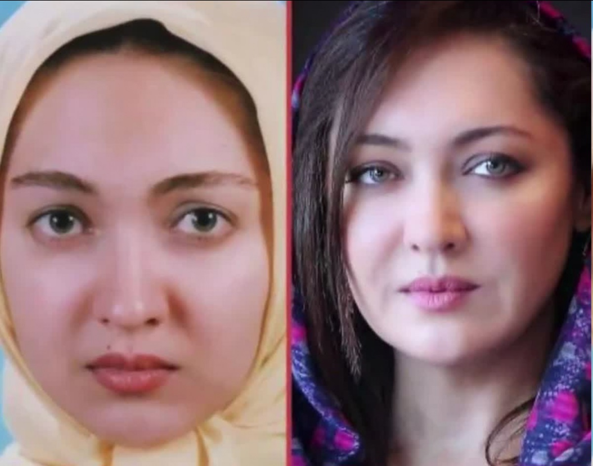 نوجوانی بازیگران مشهور زن ایرانی
