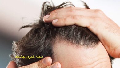 جلوگیری از ریزش مو مردان با روش‌های خانگی