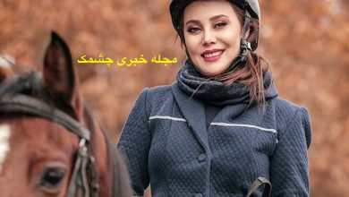 آرام جعفری قبل از عمل زیبایی