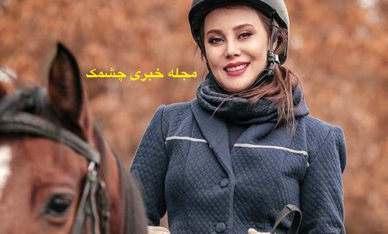 آرام جعفری قبل از عمل زیبایی