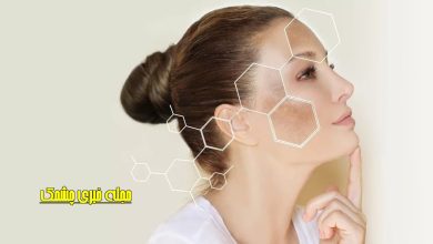 خوراکی هایی که چهره را کدر می کنند