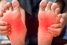 علل داغ شدن کف پا