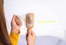 ریزش مو ناشی از پرکاری و کم کاری تیروئید