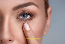 از بین بردن پف چشم