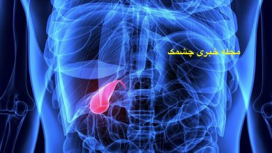 غذاهای مضر برای سنگ کیسه صفرا
