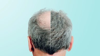 رشد موها با یک ماده شیرین کننده