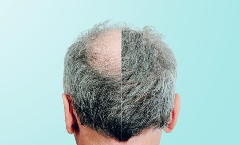 رشد موها با یک ماده شیرین کننده