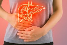 روش های درمان کبد چرب